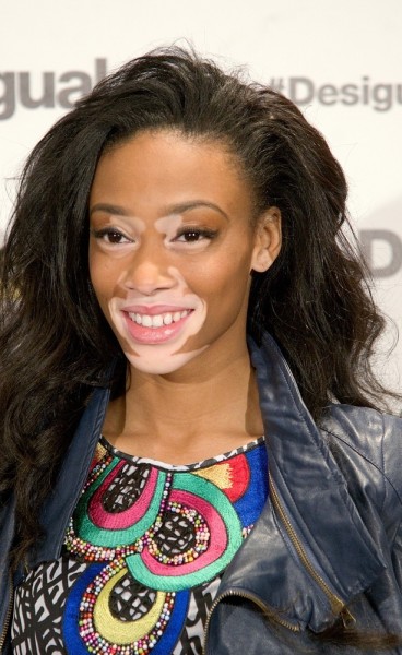 Winnie Harlow Presented as New Desigual Face for the Spring-Summer 2015 Campaign "Say Something Nice"